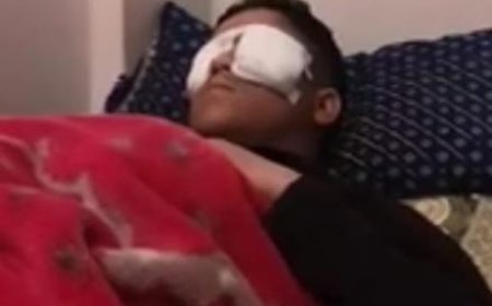 انفجار بطارية هاتف في وجه تلميذ يتابع دراسته عن بعد