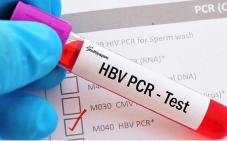 جميع الصحافيين مطالبون ب PCR لولوج المركب الرياضي بفاس